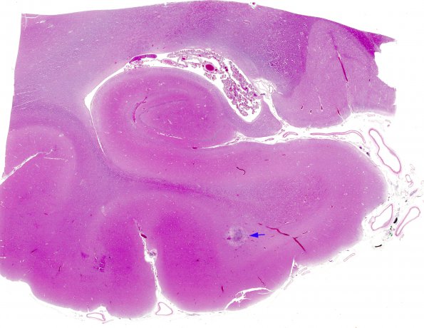 1A1 Rabies (AANP 1997-08) Hippocampus H&E whole mount