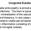 0A Rubella - Text