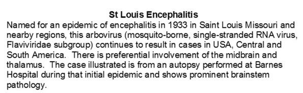 0A Saint Louis Encephalitis - Text