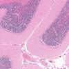 1D1 Hypoglycemia, chronic (Case 1) H&E N9 4X 2