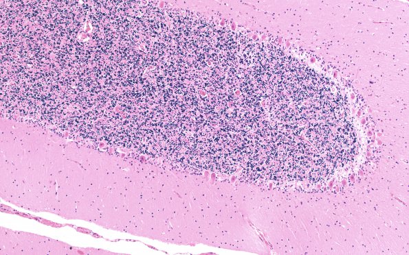 1D2 Hypoglycemia, chronic (Case 1) H&E N9 10X 1