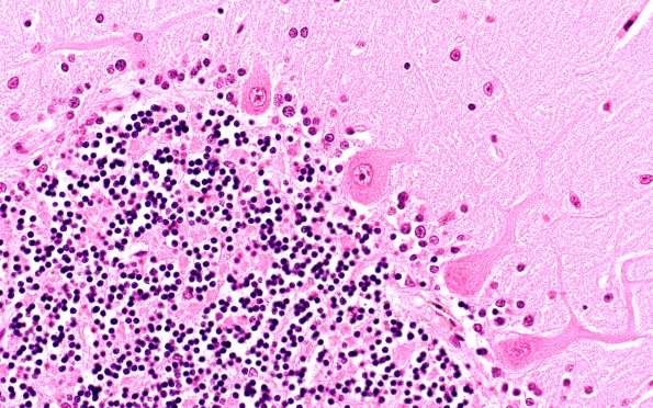 2D4 Hypoglycemia (Case 2) H&E N9 40X