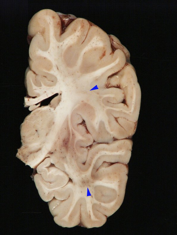 1B3 Leigh Dz (Case 1) A_4 copy