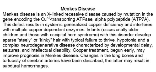 0A Menkes disease - Text