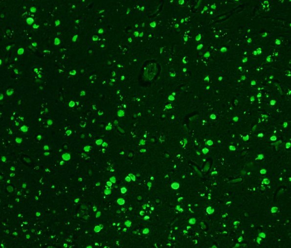 1D1 NCL (Case 1) Cerebral cortex Autofl 6