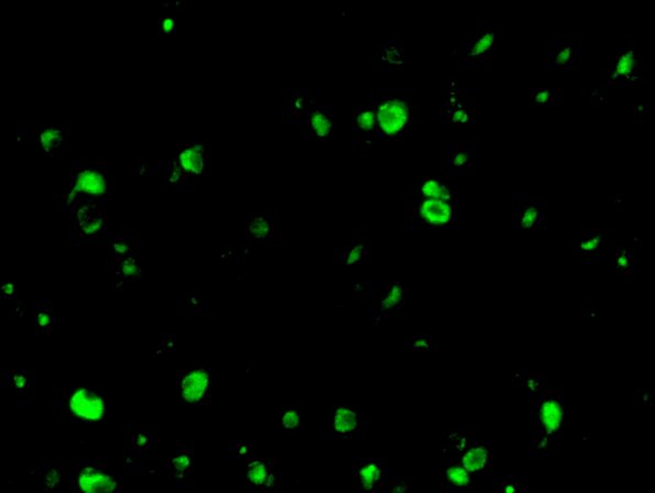 1D2 NCL Case 1) Cerebral cortex Autofl 4