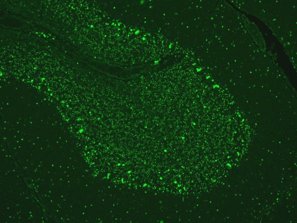 1D3 NCL (Case 1) Cbell Autofl 1A