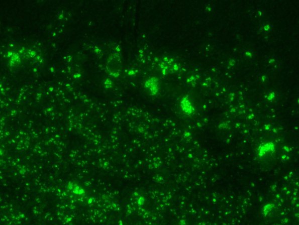 1D4 NCL (Case 1) Cbell Autofl 4a