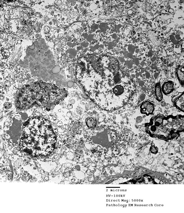 1F1A Case 1 NCL CBELL_009 - Copy