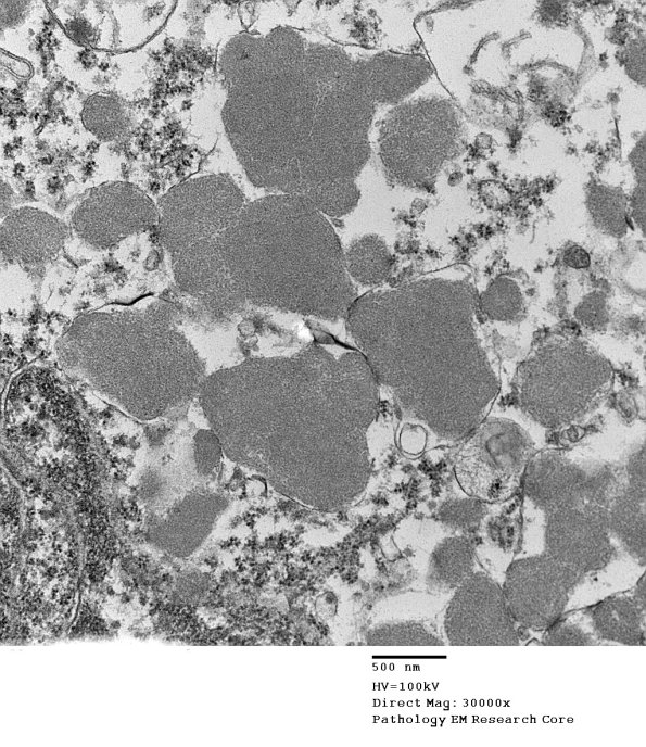 1F1C Case 1 NCL CBELL_011 - Copy