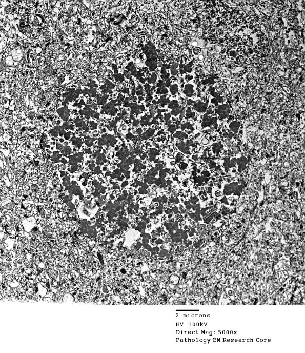 1F1D Case 1 NCL CBELL_019 - Copy