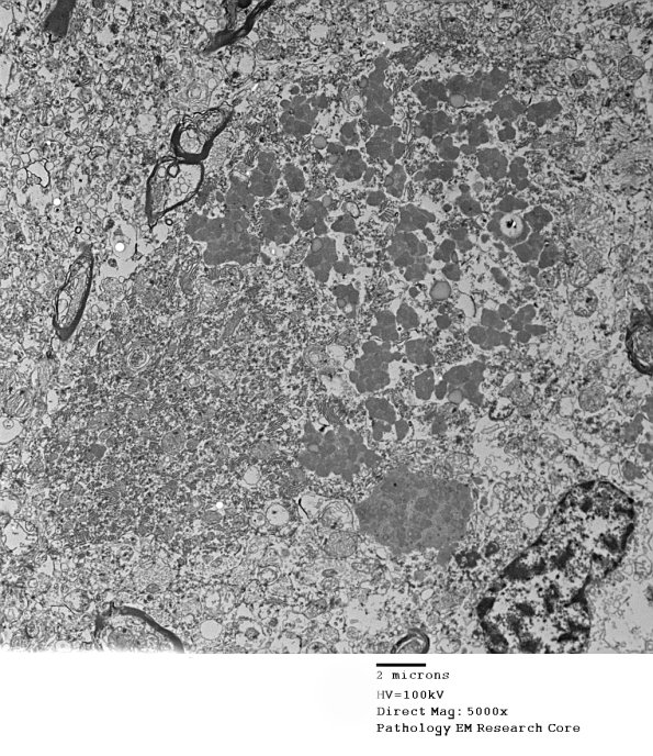 1F1E Case 1 NCL CBELL_021 - Copy