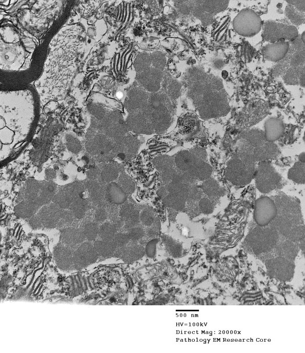 1F1F Case 1 NCL CBELL_022 - Copy