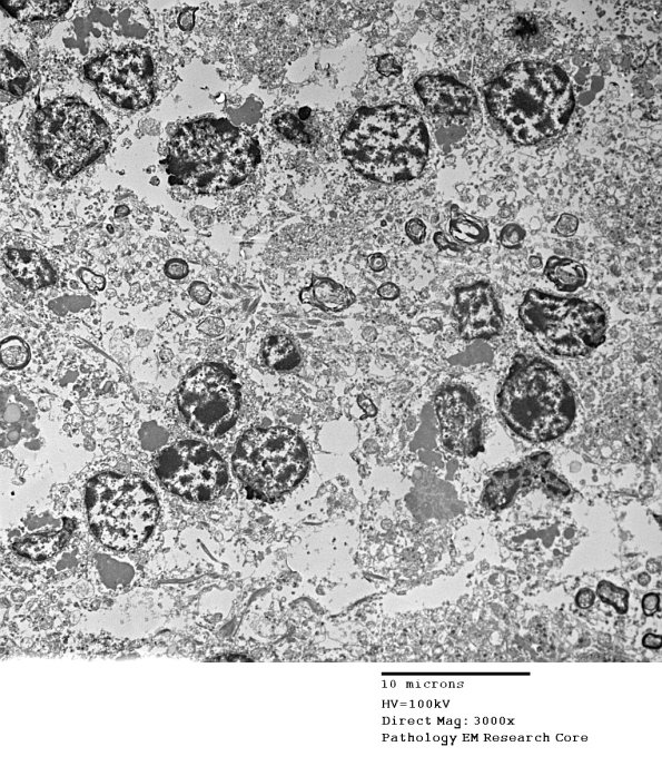 1F2A Case 1 NCL CBELL_005 - Copy