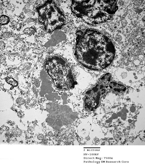 1F2B Case 1 NCL CBELL_006 - Copy