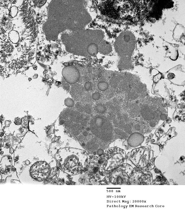 1F2C Case 1 NCL CBELL_007 - Copy