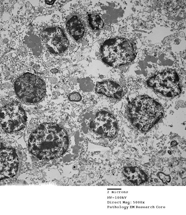 1F3A Case 1 NCL CBELL_008 - Copy