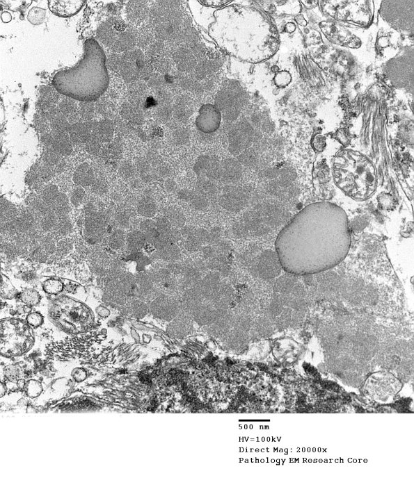 1F3B Case 1 NCL CBELL_012 - Copy