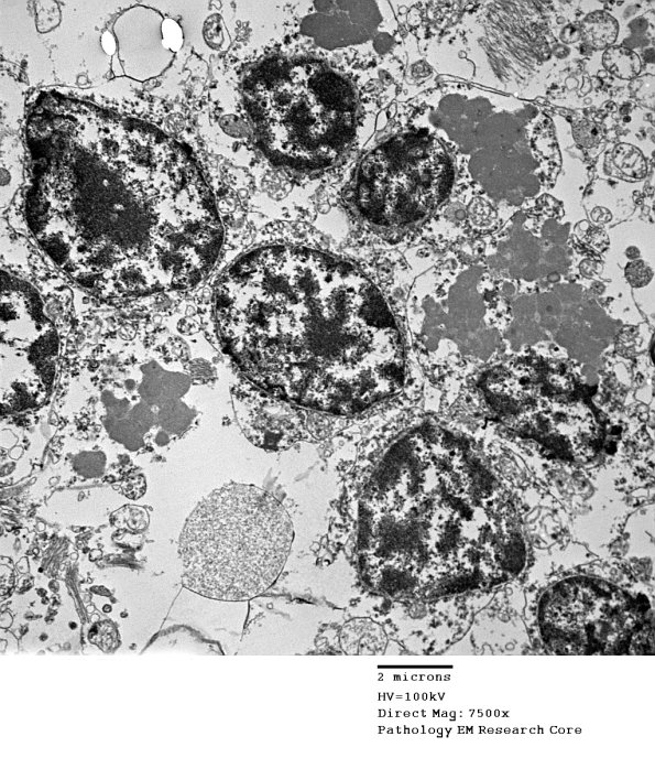 1F4A Case 1 NCL CBELL_024 - Copy
