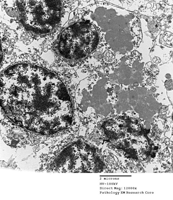 1F4B Case 1 NCL CBELL_025 - Copy
