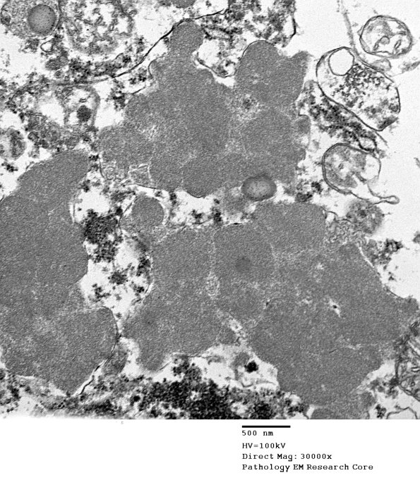 1F4C Case 1 NCL CBELL_026 - Copy