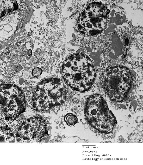 1F5 Case 1 NCL CBELL_014 - Copy