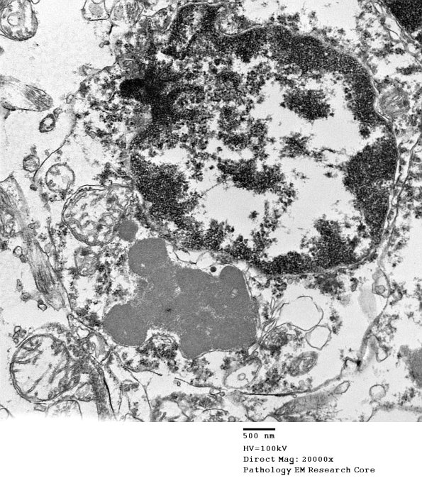 1F6 Case 1 NCL CBELL_027 - Copy