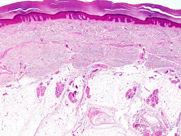 2A1 NCL (Kuf's Dz, Case 2) Skin 1.jpg