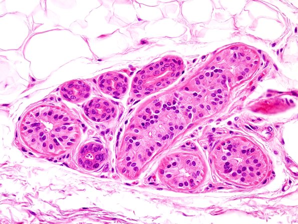 2A2 NCL (Kuf's Dz, Case 2) Skin 2.jpg