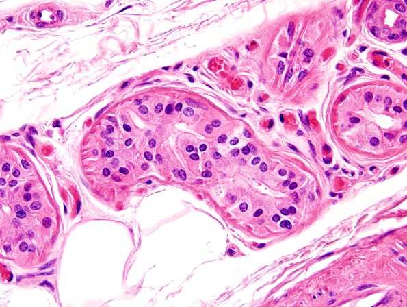 2A3 NCL (Kuf's Dz, Case 2) Skin 3.jpg