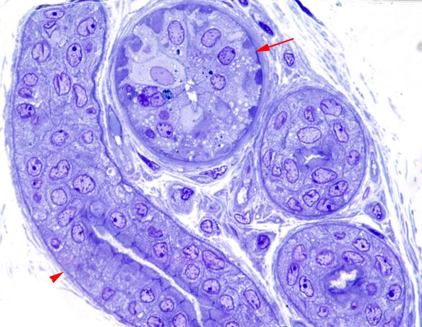 2C2 Kuf's Dz (Case 2) Plastic correlates with EM 1 copy.jpg