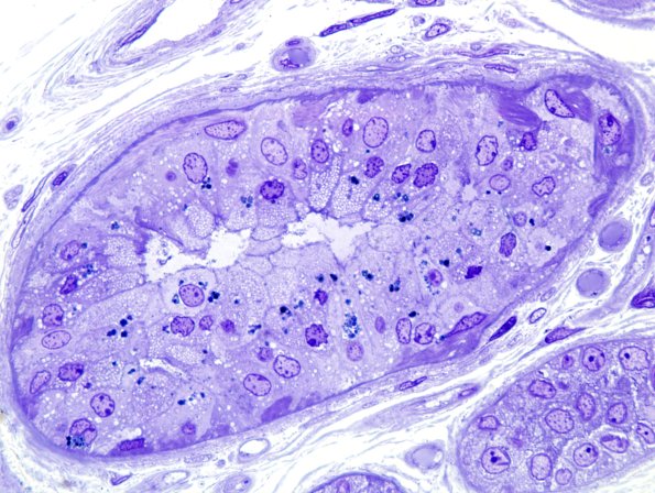 2C3 Kuf's Dz (Case 2) Plastic 3.jpg