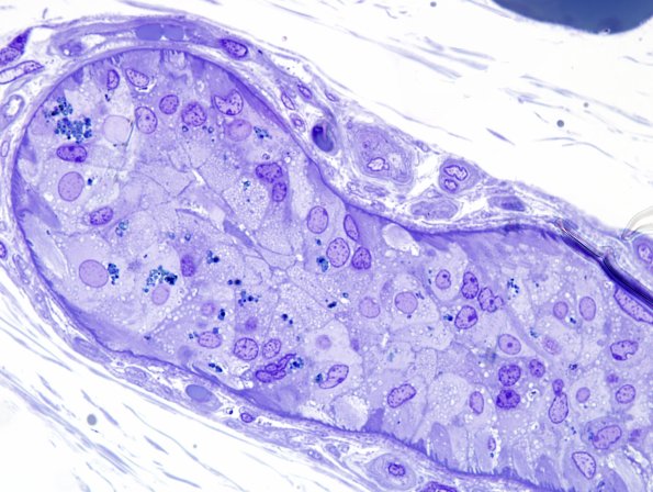 2C4 Kuf's Dz (Case 2) Plastic 1.jpg