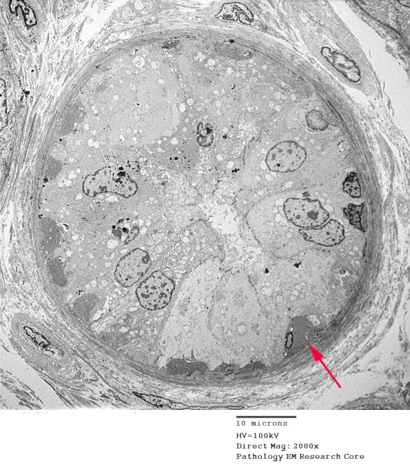2D1B Kuf's Dz (Case 2) Skin 035 copy - Copy