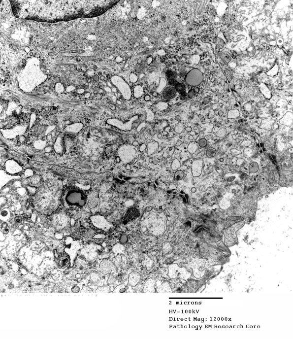 2D9A Kuf's Dz (Case 2) Skin 061 - Copy