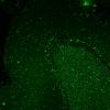2H5 NCL (Case 2) L14 Autofluorescence 6A
