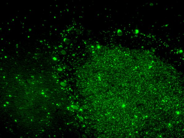 2H6 NCL (Case 2) L14 Autofluorescence 6C