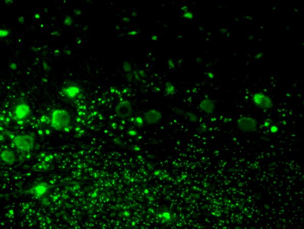 2H7 NCL (Case 2) L14 Autofluorescence 4B