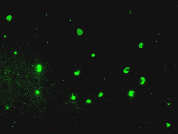 2H8 NCL (Case 2) L14 Autofluorescence dentate 2