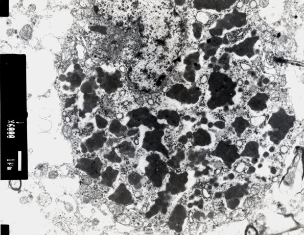 3E2 NCL (Case 3) EM 3