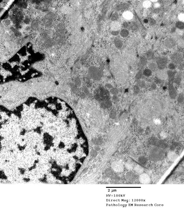 9A3A NCL (Case 9) Skin Bx EM 146A - Copy