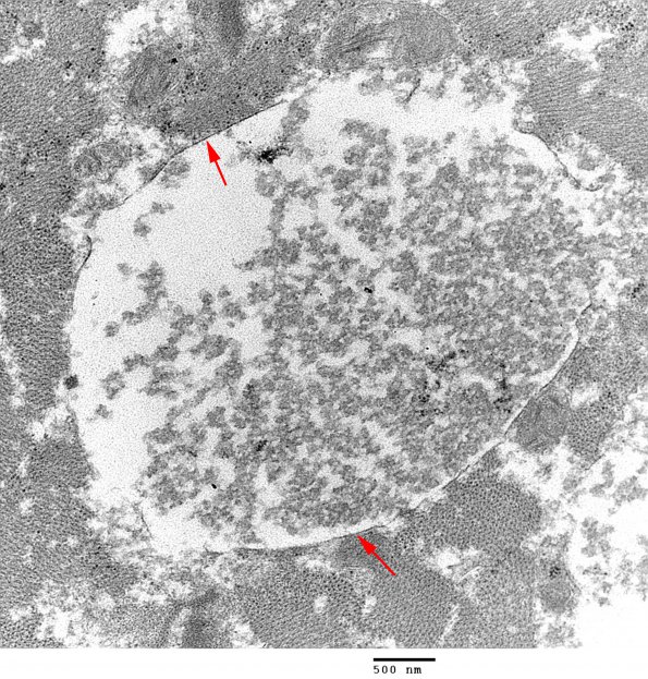 2C3 Pompe Dz (Case 2) EM 9 - Copy copy