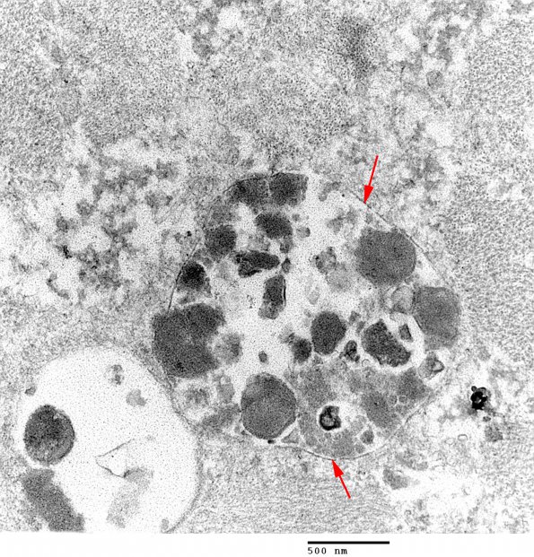 2C4 Pompe Dz (Case 2) EM 13 - Copy copy