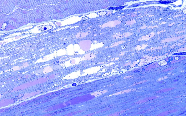 5C3 Muscle (Case 5) Plastic 100X 2