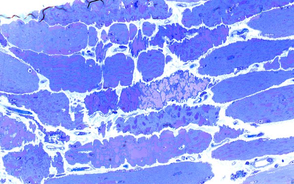 5C4 Muscle (Case 5) Plastic 40X 3