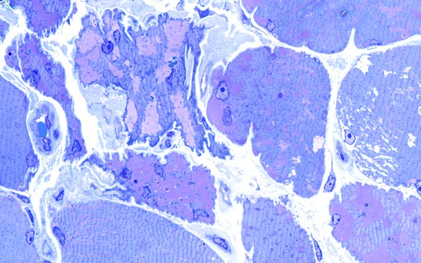 5C5 Muscle (Case 5) Plastic 100X 3