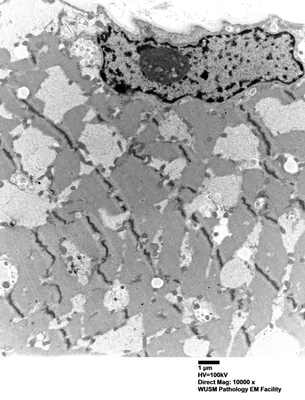 5D1 Muscle (Case 5) EM009 - Copy