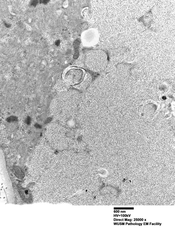 5D10 Muscle (Case 5) EM021 - Copy