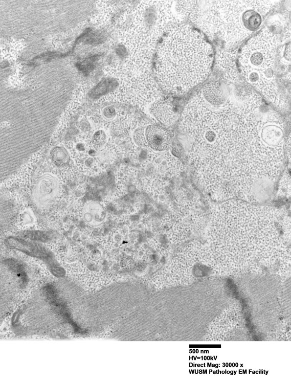 5D12 Muscle (Case 5) EM024 - Copy