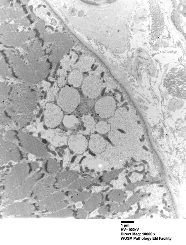 5D13 Muscle (Case 5) EM025 - Copy